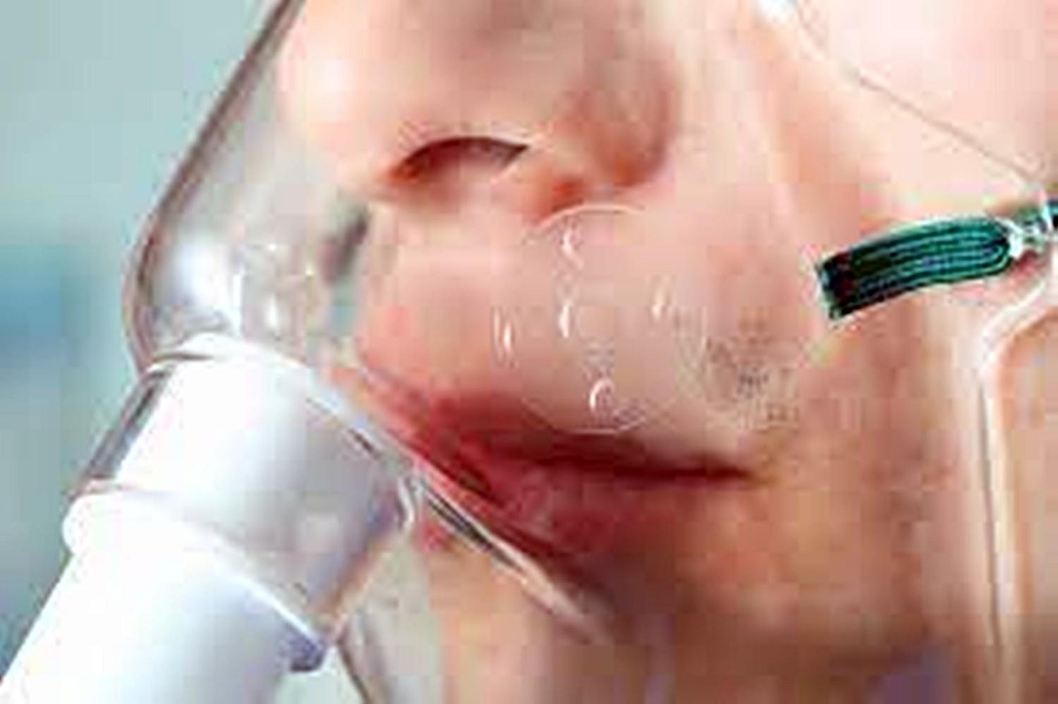 Nebulização com hidroxicloroquina mata três no RS