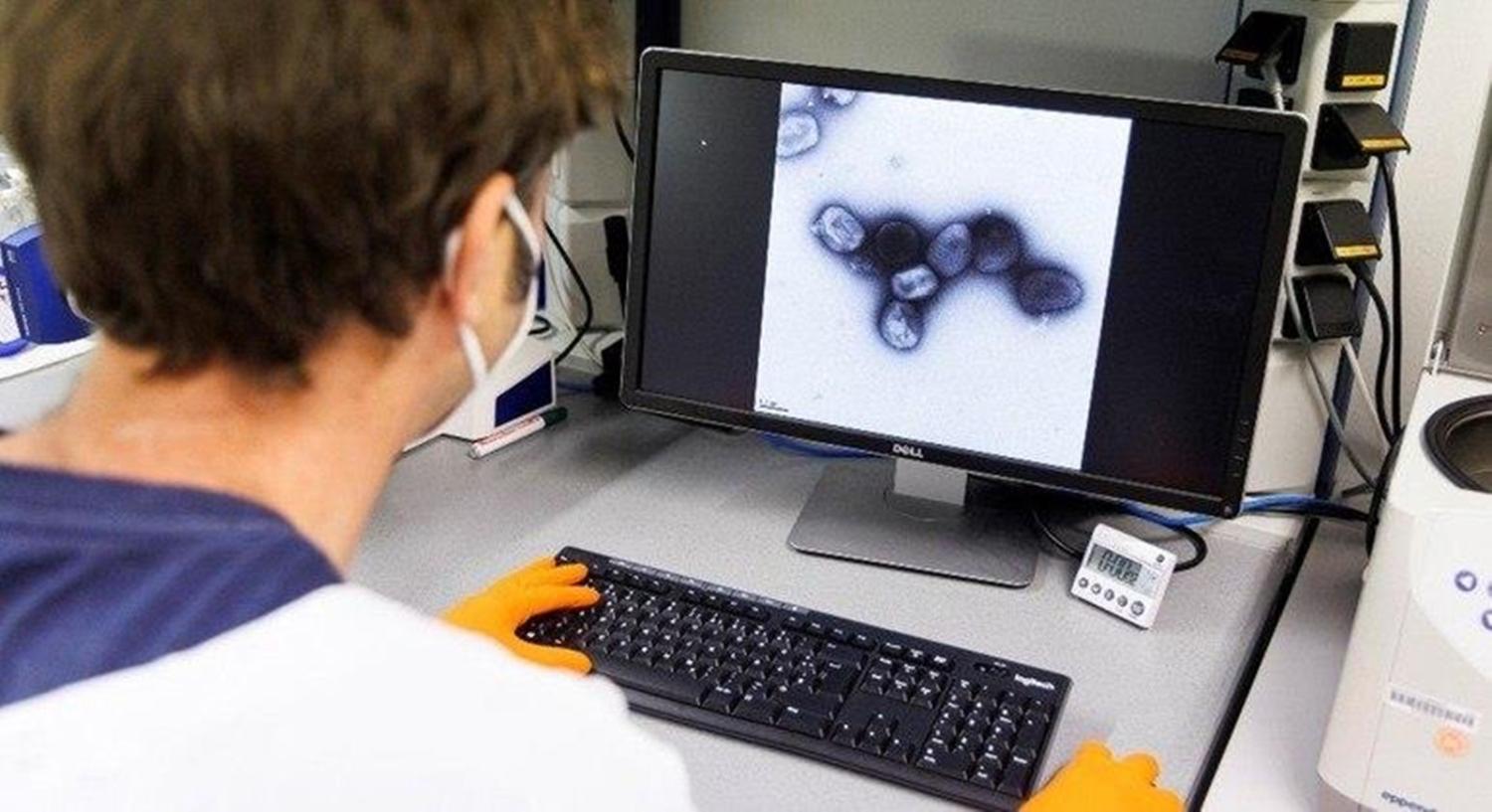 Cientistas descobrem 47 mutações no vírus da varíola do macaco