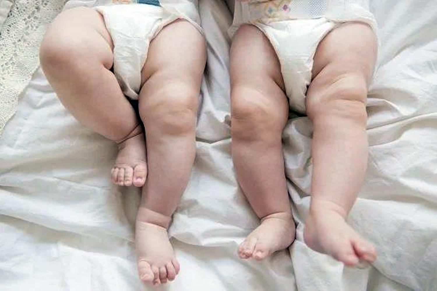Com 5% de chance de ser mãe, mulher engravida 2 vezes na mesma semana