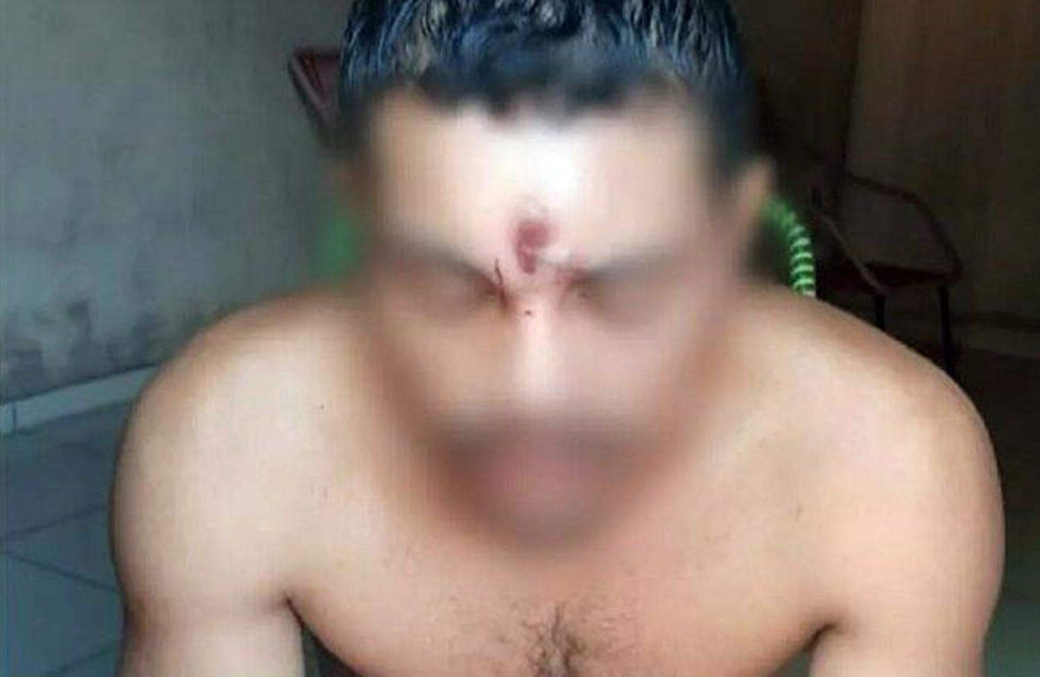 Homem leva tiro na testa, cai de moto e vai para casa dormir
