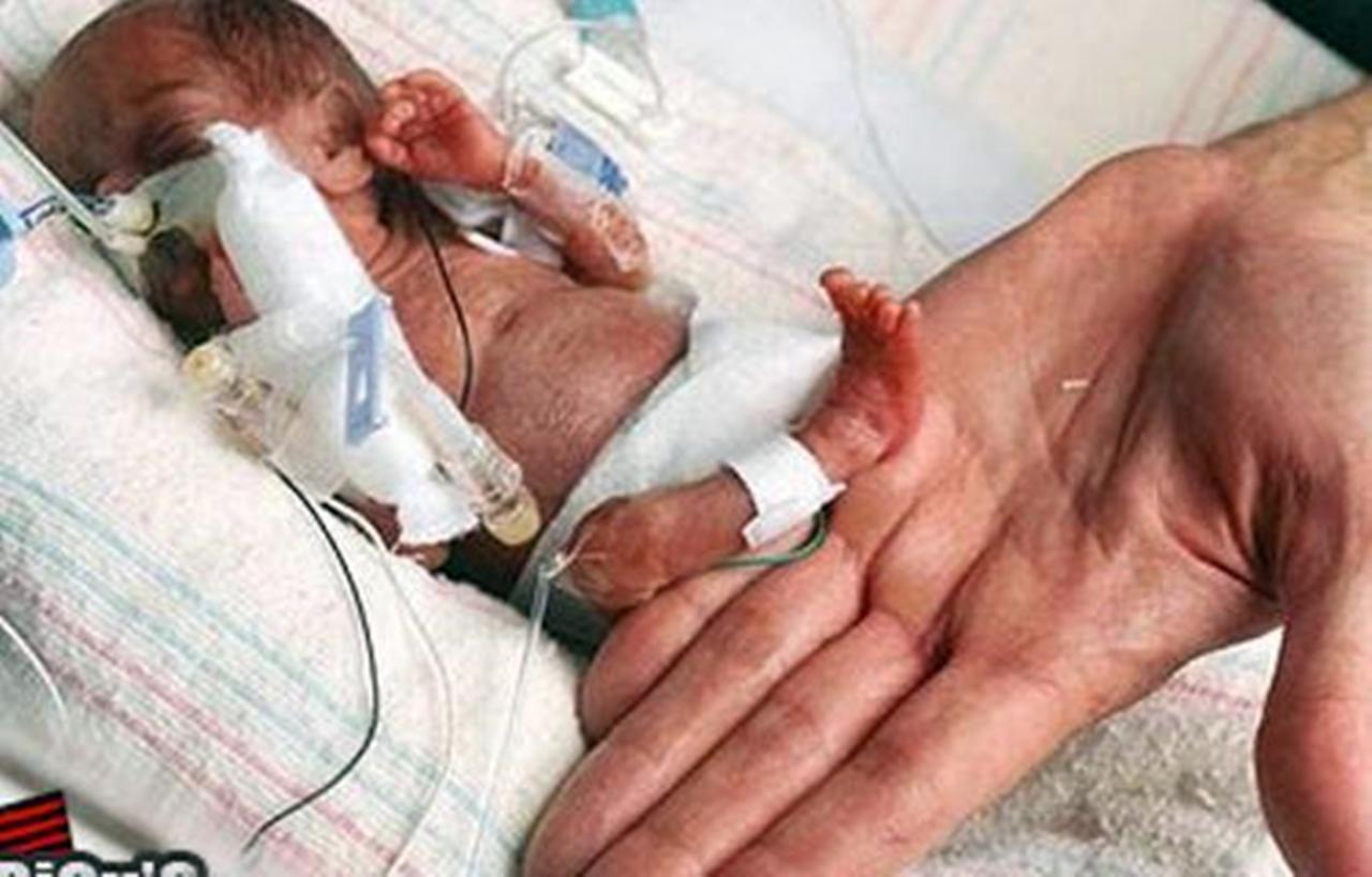 Menor bebê já registrada em hospital público dentro do Brasil recebe alta após 5 meses; conheça a história