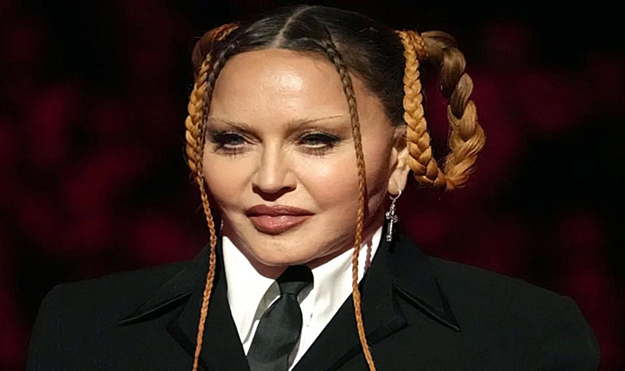 Madonna é internada em UTI e adia turnê mundial