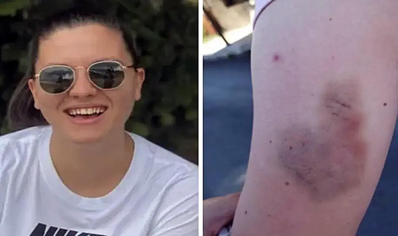 Mulher é multada por 'lutar em excesso' contra homem que a agrediu sexualmente