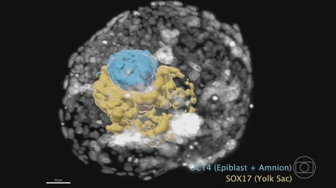 ISRAEL - Cientistas anunciam criação de embrião humano sem espermatozoide nem óvulo