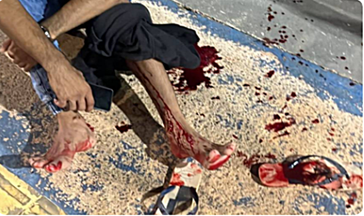 Rondônia: Ataque a tiros deixa dois jovens baleados em Vilhena