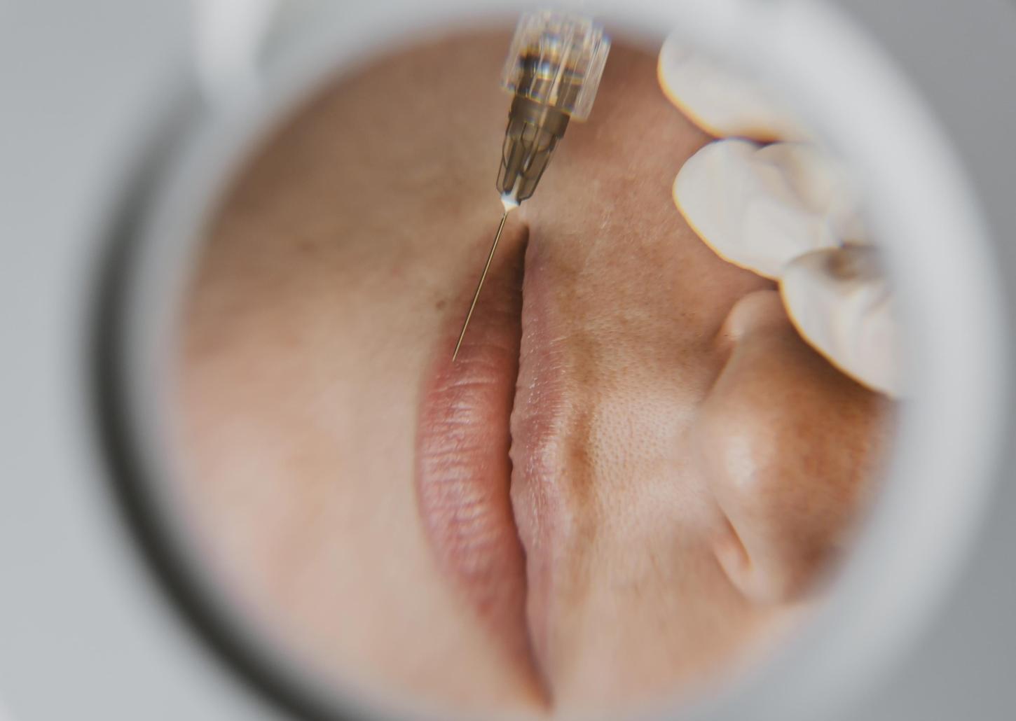 Justiça indefere pedido do CFM e mantém parecer do Cofen sobre Enfermagem Estética