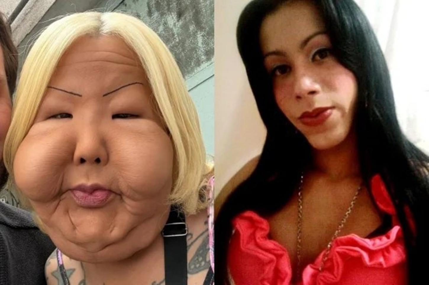 Quem é 'Juju do Pix', influenciadora que passou por cirurgia para retirar óleo mineral do rosto