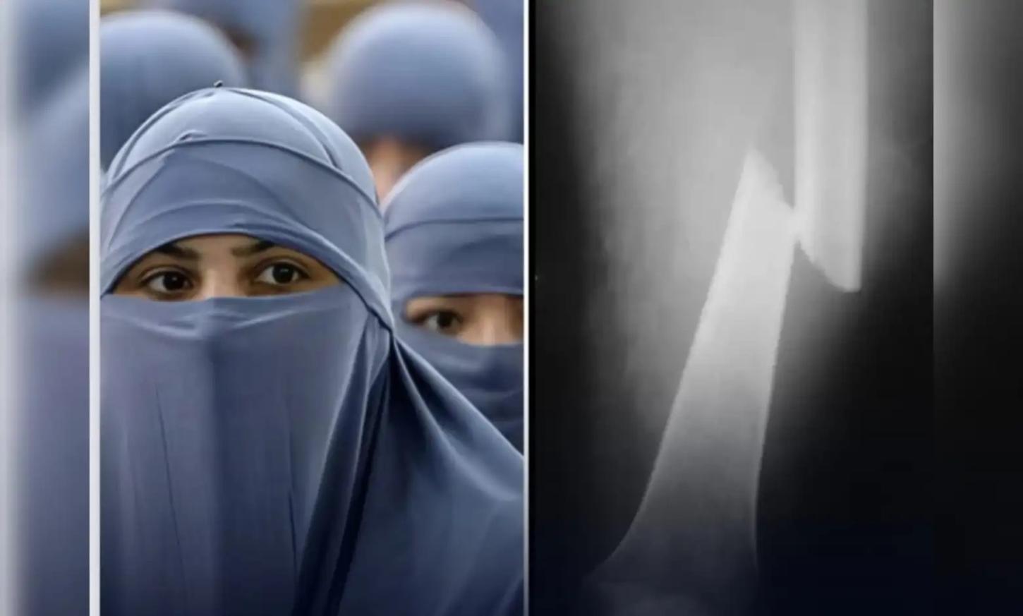 AFEGANISTÃO - Talibã autoriza agressões contra esposas, desde que não haja fratura