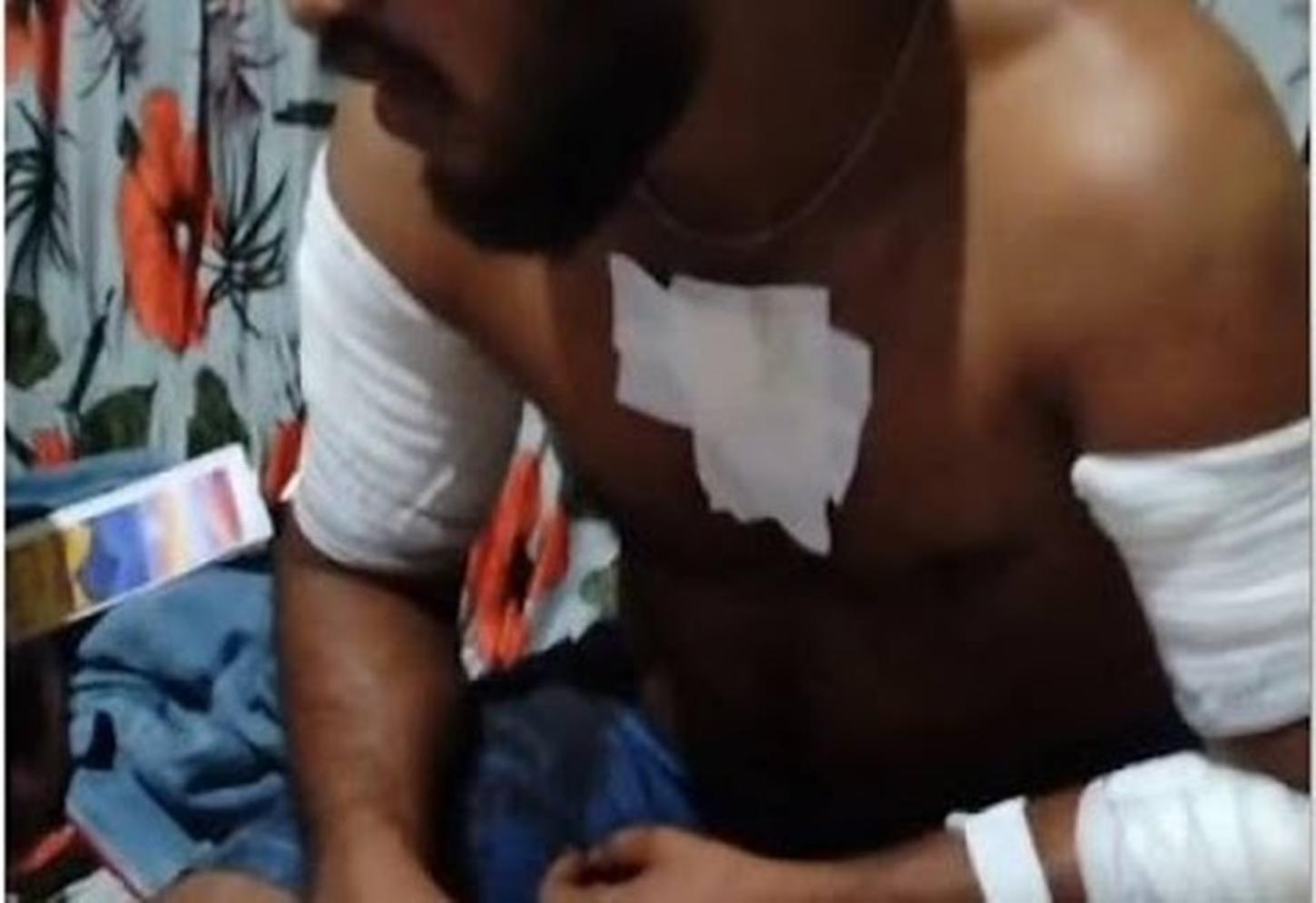 Homem sobrevive a 7 facadas desferidas pela própria esposa em Rondônia